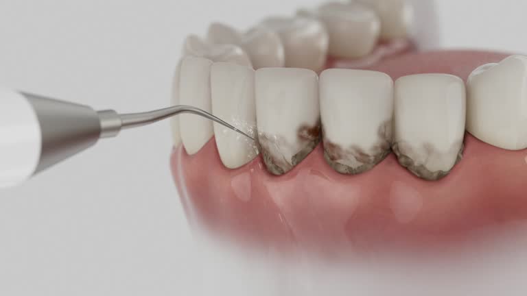 Reliable Dental Implants contractor in Windber, PA by Smile Center Dentistry